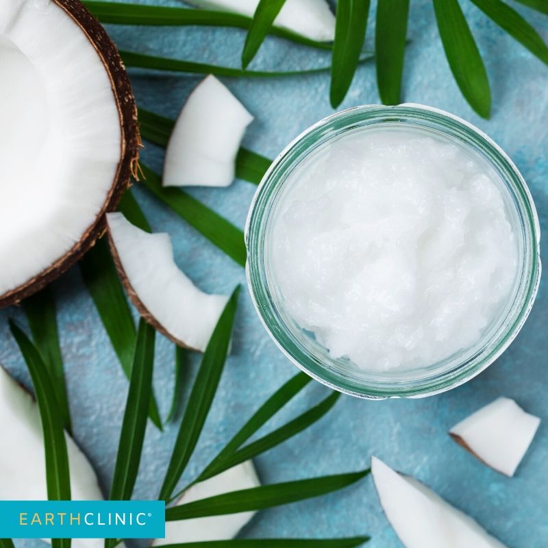 Coconut Oil remedy on Earth Clinic.